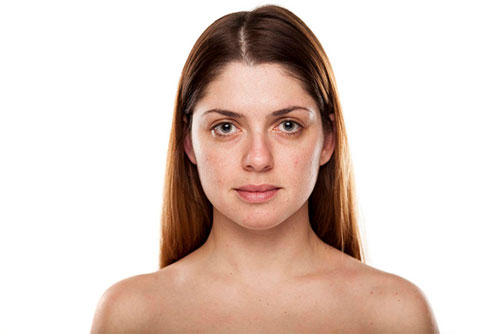 冬天脸红怎么回事 脸部潮红的原因教你怎么科