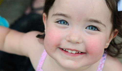 冬天脸红怎么回事 脸部潮红的原因教你怎么科