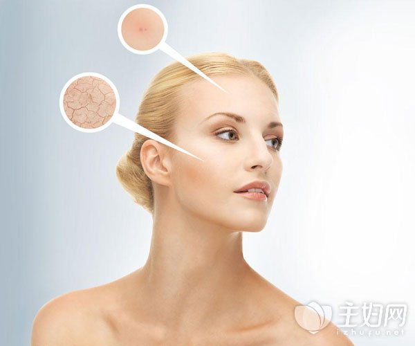 夏天脸痒是怎么回事 皮肤干燥的原因及护理方